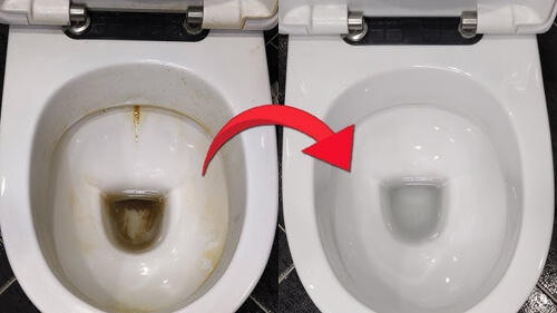 мочевой камень в унитазе